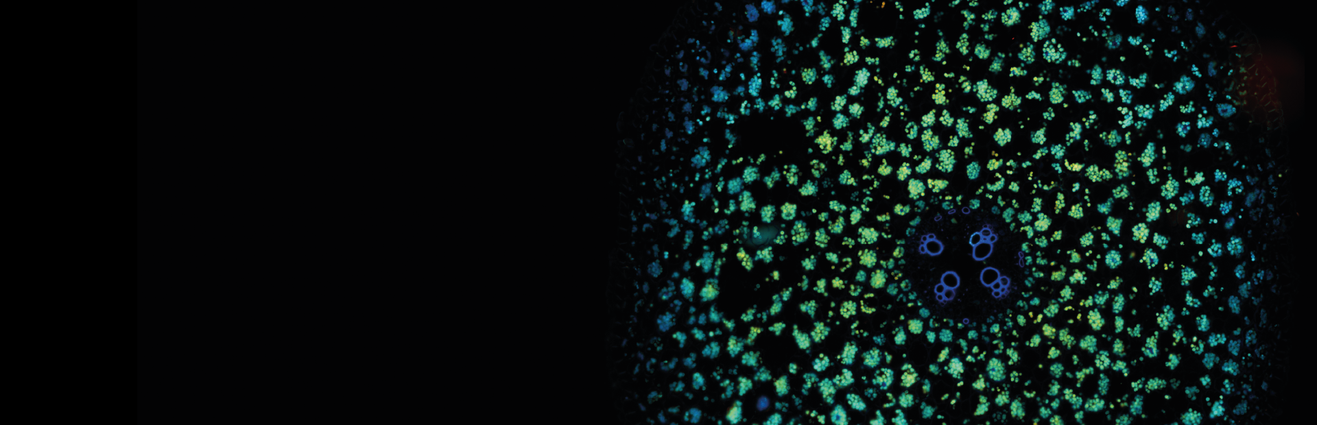 Understanding Fluorescence Lifetime Imaging Microscopy (FLIM)